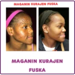 maganin kurajen fuska android application logo